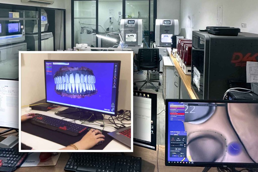 DentaFly Antalya In-house laboratory DentaFly Antalya In-house laboratory